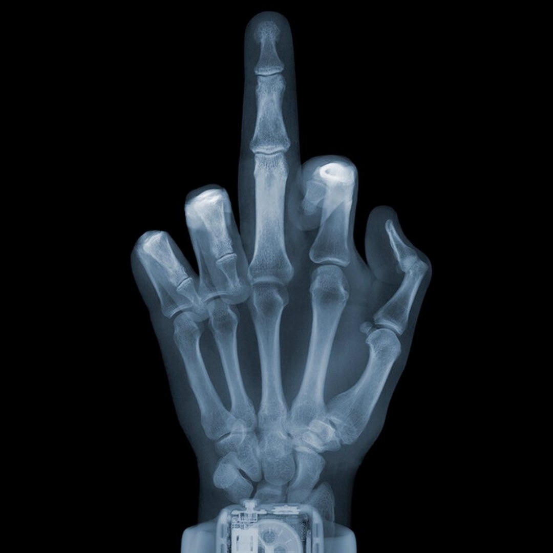 Finger with Watch, 2019 (M)